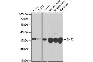 Western blot analysis of extracts of various cell lines using GNB2 Polyclonal Antibody at dilution of 1:1000.
