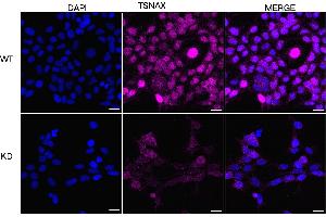 anti-Translin-Associated Factor X (TSNAX) antibody