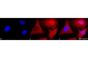 Immunocytochemistry/Immunofluorescence analysis using Mouse Anti-Ubiquitin Monoclonal Antibody, Clone 6C11-B3 . (Ubiquitin antibody  (PerCP))