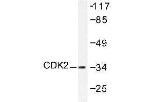 Image no. 1 for anti-Cyclin-Dependent Kinase 2 (CDK2) antibody (ABIN265344) (CDK2 antibody)