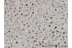 Immunoperoxidase of monoclonal antibody to H3F3B on formalin-fixed paraffin-embedded human liver. (H3F3B antibody  (AA 1-136))
