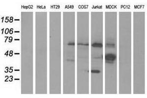 Image no. 1 for anti-Kelch-Like 2, Mayven (KLHL2) (AA 1-100), (AA 494-593) antibody (ABIN1490547) (KLHL2 antibody  (AA 1-100, AA 494-593))