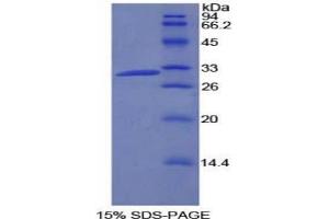SDS-PAGE analysis of Rat PIK3C2b Protein. (Phosphatidylinositol-4-Phosphate 3-Kinase, Catalytic Subunit Type 2 beta (PIK3C2B) Peptide)