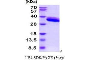 SDS-PAGE (SDS) image for Protease, serine, 22 (PRSS22) (AA 33-307) protein (His tag) (ABIN5854623)