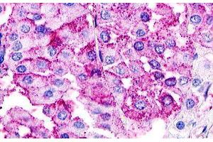 Image no. 2 for anti-G Protein-Coupled Receptor 21 (GPR21) (Cytoplasmic Domain) antibody (ABIN1048777) (GPR21 antibody  (Cytoplasmic Domain))