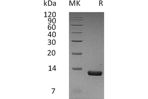 CCL8 Protein (His tag)