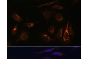 Immunofluorescence analysis of U-2 OS cells using VMP1 Polyclonal Antibody at dilution of 1:100 (40x lens).