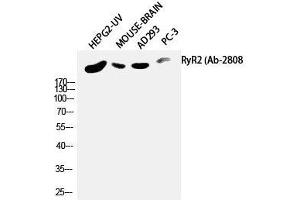 Western Blot analysis of HepG2-UV, Mouse brain, AD293T, PC-3 using RYR2 Polyclonal Antibody at dilution of 1:2000. (RYR2 antibody)