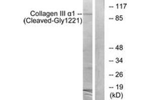 Western blot analysis of extracts from A549 cells, treated with etoposide 25uM 24h, using Collagen III alpha1 (Cleaved-Gly1221) Antibody.
