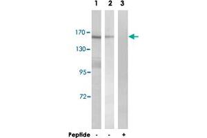 Western blot analysis of extracts from K-562 cells (Lane 1 and lane 3) and HT-29 cells (Lane 2), using MLH3 polyclonal antibody . (MLH3 antibody)