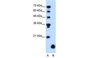 Image no. 1 for anti-Proteolipid Protein 2 (PLP2) (C-Term) antibody (ABIN205077) (PLP2 antibody  (C-Term))