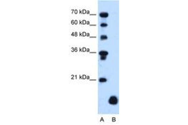 PLP2 antibody  (C-Term)
