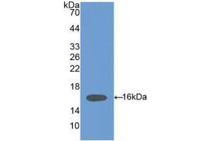Western blot analysis of recombinant Mouse HPA. (HPSE antibody  (AA 280-412))