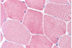 Human Skeletal Muscle (formalin-fixed, paraffin-embedded) stained with CASP6 antibody ABIN213918 at 5 ug/ml followed by biotinylated goat anti-rabbit IgG secondary antibody ABIN481713, alkaline phosphatase-streptavidin and chromogen. (Caspase 6 antibody  (N-Term))