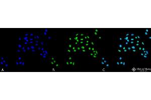 Immunocytochemistry/Immunofluorescence analysis using Rabbit Anti-ATG5 Polyclonal Antibody . (ATG5 antibody  (N-Term) (APC))