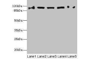 Western blot All lanes: COPB1 antibody at 1 μg/mL Lane 1: Hela whole cell lysate Lane 2: Jurkat whole cell lysate Lane 3: NIH/3T3 whole cell lysate Lane 4: Mouse liver tissue Lane 5: A549 whole cell lysate Secondary Goat polyclonal to rabbit IgG at 1/10000 dilution Predicted band size: 108 kDa Observed band size: 108 kDa