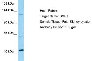 Western Blotting (WB) image for anti-BMS1 Homolog, Ribosome Assembly Protein (BMS1) (C-Term) antibody (ABIN2790143) (BMS1 antibody  (C-Term))