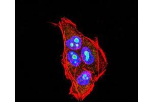 Immunohistochemistry (IHC) image for anti-Phospholipase C gamma 2 (PLCG2) (AA 826-985) antibody (ABIN5542311)
