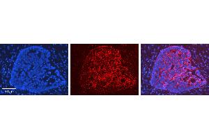 Immunohistochemistry (IHC) image for anti-Heme Oxygenase (Decycling) 1 (HMOX1) (N-Term) antibody (ABIN2782158)