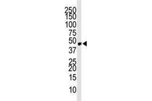 Image no. 1 for anti-Chemokine Binding Protein 2 (CCBP2) (C-Term) antibody (ABIN357386) (CCBP2 antibody  (C-Term))