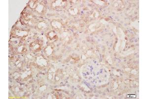 Formalin-fixed and paraffin embedded mouse kidney labeled with Rabbit Anti Arginase II Polyclonal Antibody, Unconjugated (ABIN1387473) at 1:200 followed by conjugation to the secondary antibody and DAB staining (ARG2 antibody  (AA 181-290))