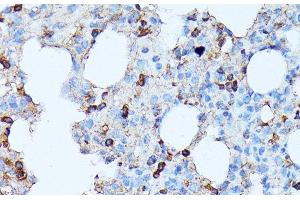 Immunohistochemistry of paraffin-embedded Rat lung using CXCR1 Polyclonal Antibody at dilution of 1:100 (40x lens). (CXCR1 antibody)