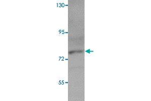 Western blot analysis of K-562 cells with PIAS3 polyclonal antibody  at 1 ug/mL dilution. (PIAS3 antibody  (C-Term))