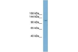 WB Suggested Anti-TRIM37 Antibody Titration:  0. (TRIM37 antibody  (Middle Region))