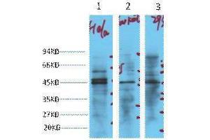 Western Blotting (WB) image for anti-Enolase 2 (Gamma, Neuronal) (ENO2) antibody (ABIN3181136) (ENO2/NSE antibody)
