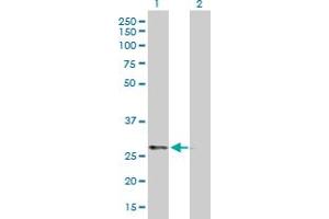 Western Blot analysis of PRKAB2 expression in transfected 293T cell line by PRKAB2 MaxPab polyclonal antibody. (PRKAB2 antibody  (AA 1-272))