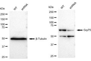 Western blotting analysis using Grp75 antibody (ABIN7798860). (Recombinant HSPA9 antibody)