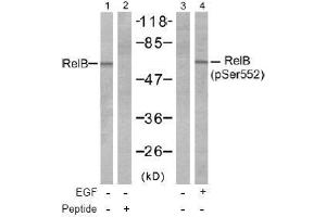 Image no. 1 for anti-V-Rel Reticuloendotheliosis Viral Oncogene Homolog B (RELB) (pSer552) antibody (ABIN197016) (RELB antibody  (pSer552))
