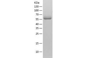 PKM2 Protein (AA 1-531) (His tag)