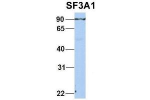 Host:  Rabbit  Target Name:  SF3A1  Sample Type:  Human Adult Placenta  Antibody Dilution:  1. (SF3A1 antibody  (N-Term))
