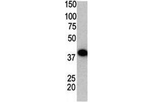 Western blot using SUMO2 antibody and GST-SUMO2 fusion protein. (SUMO2 antibody  (AA 63-93))