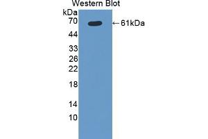Detection of Recombinant CYP11B1, Rat using Polyclonal Antibody to Cytochrome P450 11B1 (CYP11B1) (CYP11B1 antibody  (AA 1-498))