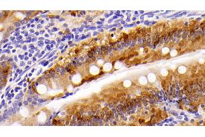 Detection of FABP1 in Rat Small intestine Tissue using Polyclonal Antibody to Fatty Acid Binding Protein 1 (FABP1)