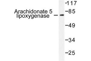 Image no. 1 for anti-Arachidonate 5-Lipoxygenase (ALOX5) antibody (ABIN271992) (ALOX5 antibody)