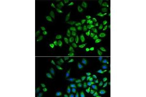 Immunofluorescence analysis of A-549 cells using ANGPTL4 Polyclonal Antibody (ANGPTL4 antibody)