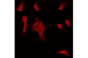 ABIN6275528 staining Hela by IF/ICC. (STK32C antibody  (Internal Region))