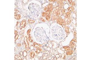 Immunohistochemical staining of human kidney tissue using XIAP polyclonal antibody  at 2 ug/mL . (XIAP antibody  (C-Term))