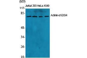Western Blot (WB) analysis of specific cells using Actinin-alpha1/2/3/4 Polyclonal Antibody. (ACTN1/2/3/4 antibody  (N-Term))