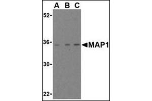 Western blot analysis of MAP-1 in EL4 cell lysate with this product at (A) 1, (B) 2, and (C) 4 μg/ml (MOAP1 antibody  (Center))