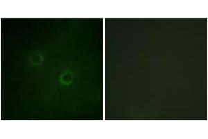 Immunofluorescence analysis of COS7 cells, using Lck (Ab-192) Antibody. (LCK antibody  (AA 161-210))