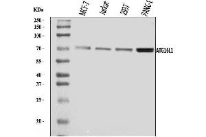 Western blot analysis of ATG16L1 using anti-ATG16L1 antibody .