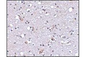Immunohistochemical staining of human brain tissue using AP30591PU-N at 2. (SLC9A1 antibody  (C-Term, N-Term))