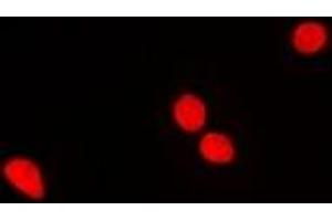 Immunofluorescent analysis of RNGTT staining in MCF7 cells.