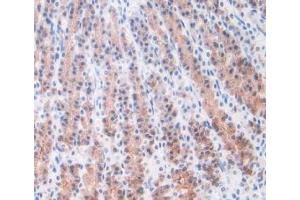 IHC-P analysis of Rat Stomach Tissue, with DAB staining. (ORM1 antibody  (AA 19-186))
