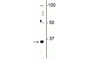 Western blot of neonatal rat brain lysate showing specific immunolabeling of the ~32 kDa Olig2 protein. (OLIG2 antibody)