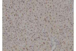 ABIN6277219 at 1/100 staining Mouse liver tissue by IHC-P.